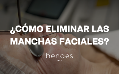 ¿Cómo eliminar las manchas de la cara?