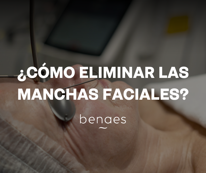 ¿Cómo eliminar las manchas de la cara?