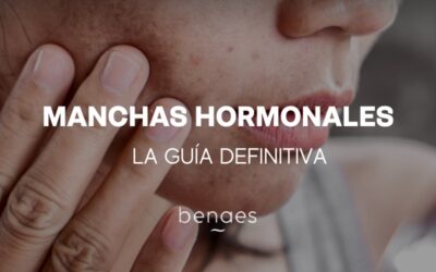 Manchas hormonales en la cara: la Guía definitiva