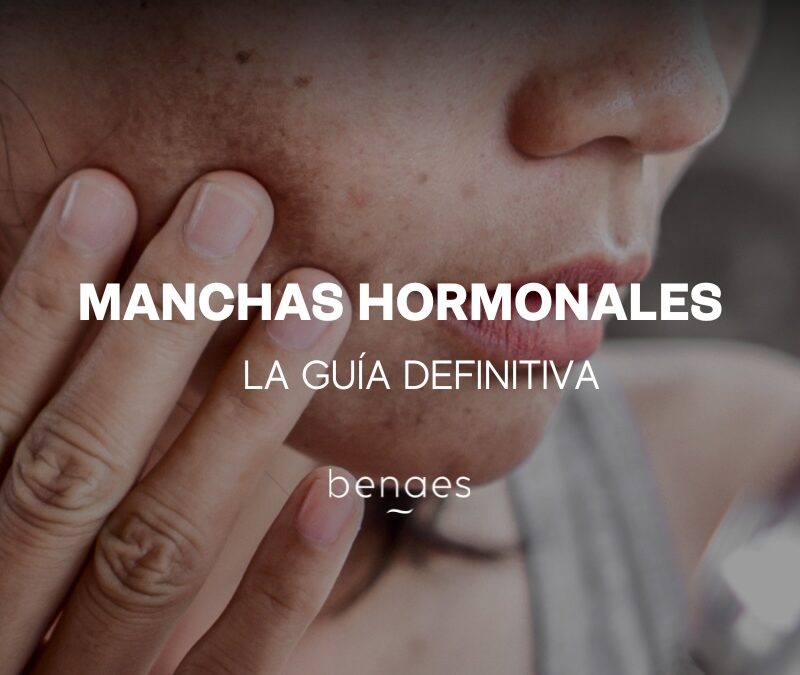 Manchas hormonales en la cara: la Guía definitiva