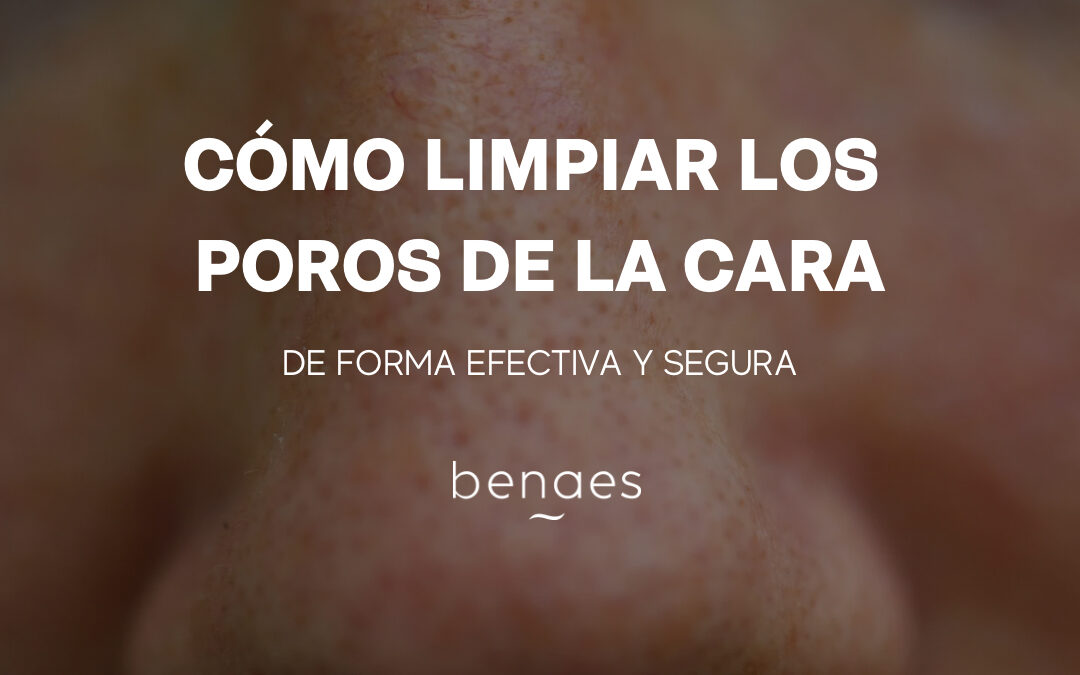 Cómo Limpiar los Poros de la Cara de Forma Efectiva y Segura